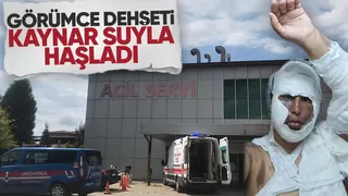 Görümce dehşet saçtı; Faslı kadını kaynar suyla yaktı